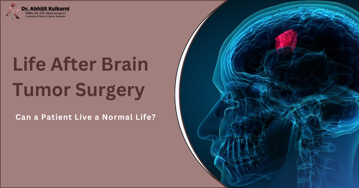 Can a Patient Live a Normal Life After Brain Tumor Surgery?